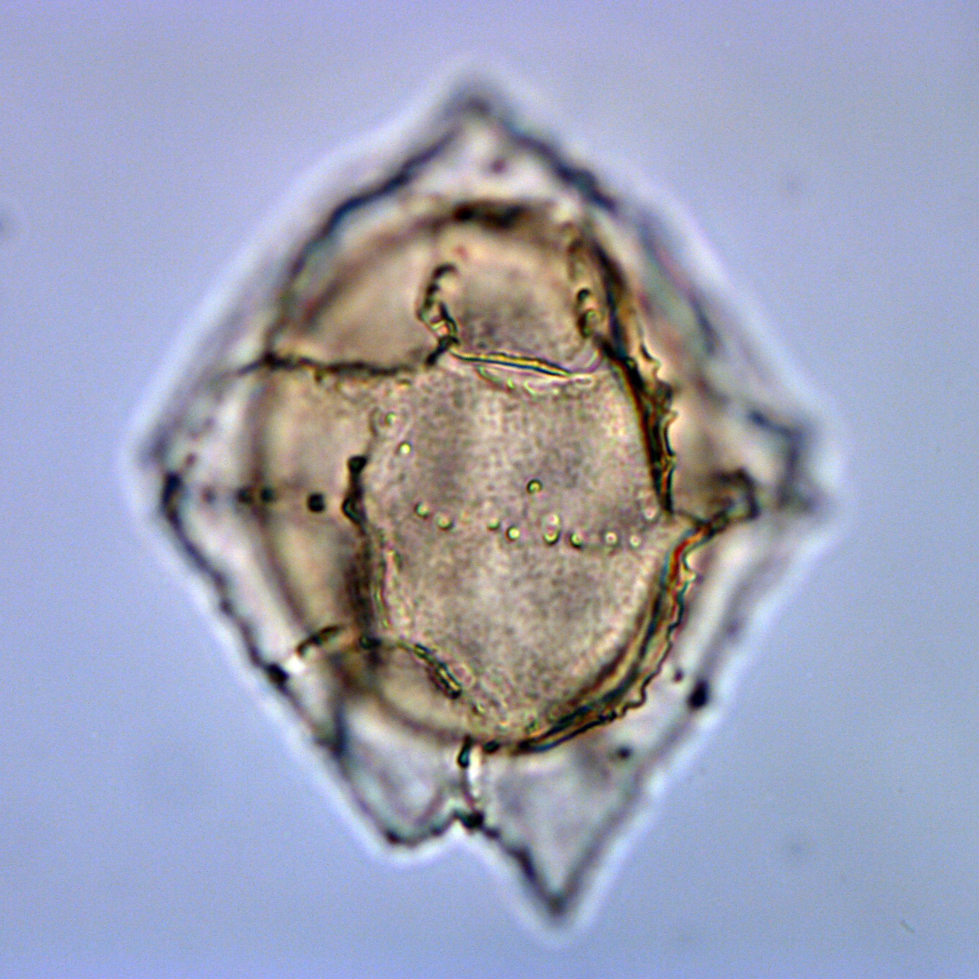 Dracodinium sp., 1410A-13H-6, 65-67, Y26-2, foto-a.jpg